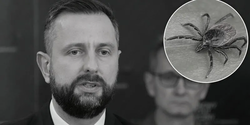 Dlaczego w wojsku preferują łyse głowy? Oto kilka istotnych powodów